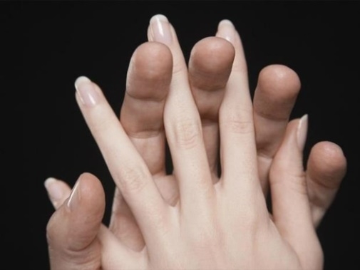 Soi ngón tay con gái phát hiện 4 dấu hiệu giàu sang, sung sướng - Thời Báo