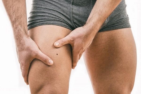 Xem bói Nốt ruồi ở Đùi Nam, Nữ có ý nghĩa gì? Tốt hay Xấu
