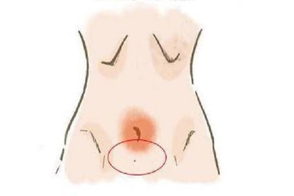 Nốt ruồi ở vùng kín đàn ông, phụ nữ nói lên điều gì? - NgayAm.com