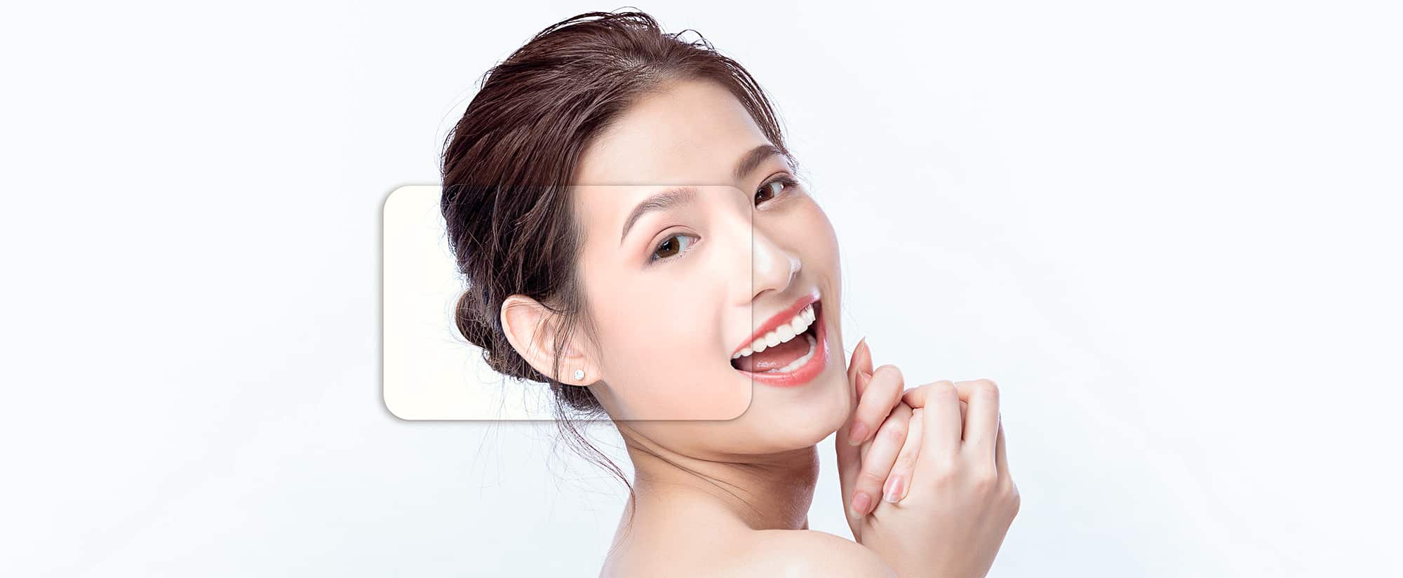 Phương pháp căng chỉ 