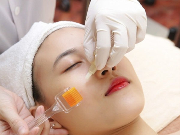 Sự thật về lăn kim - phương pháp hứa hẹn trị sẹo rỗ, xóa nám, mờ thâm